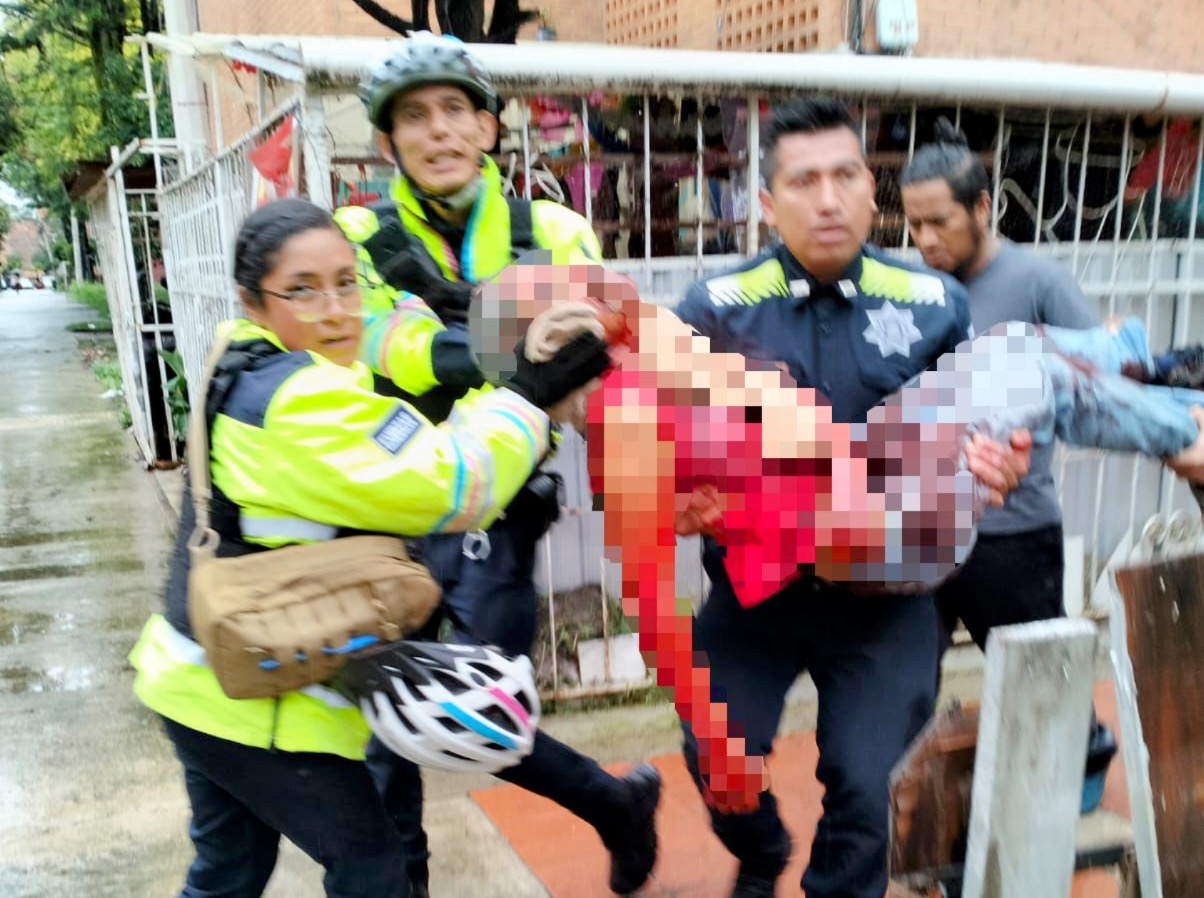 Salvan policías a hombre de morir desangrado en Agua Santa